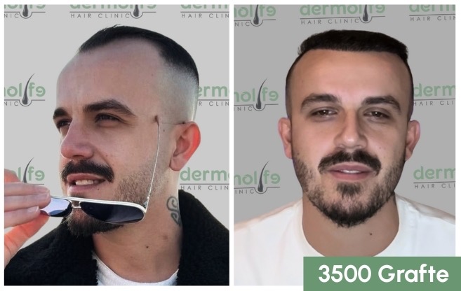 Cmimi i mbjelljes se flokeve