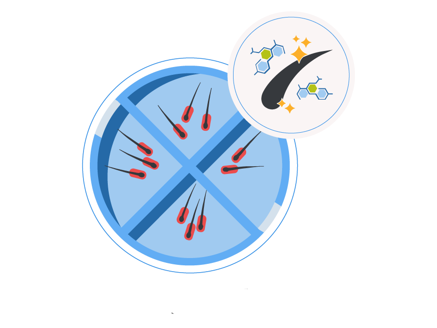 Infographic showing the hair follicle storage and enrichment before the hair transplant