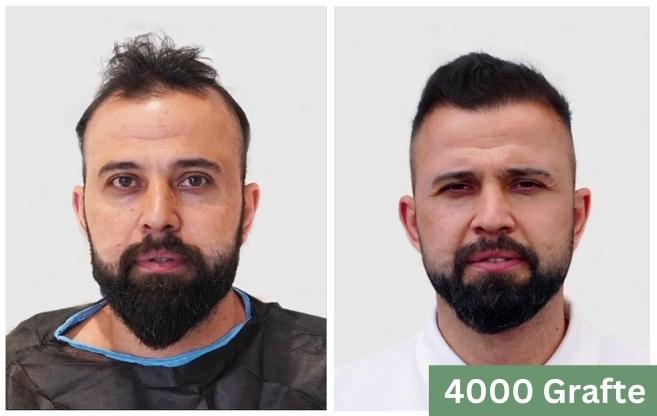 Mbjellje floku shqiperi