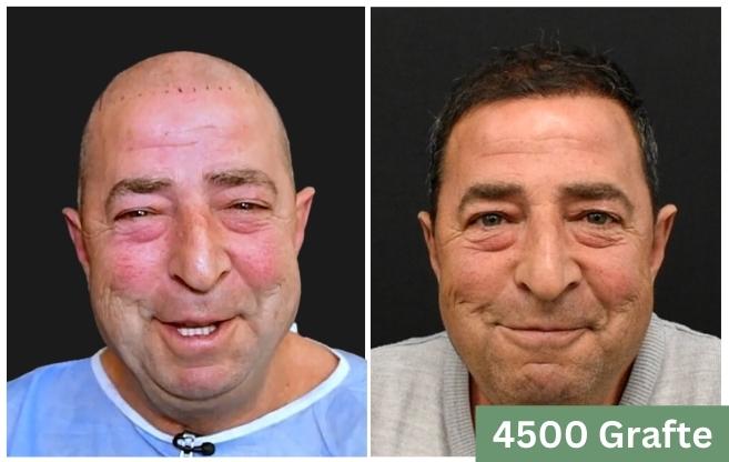 Mbjellje floku shqiperi