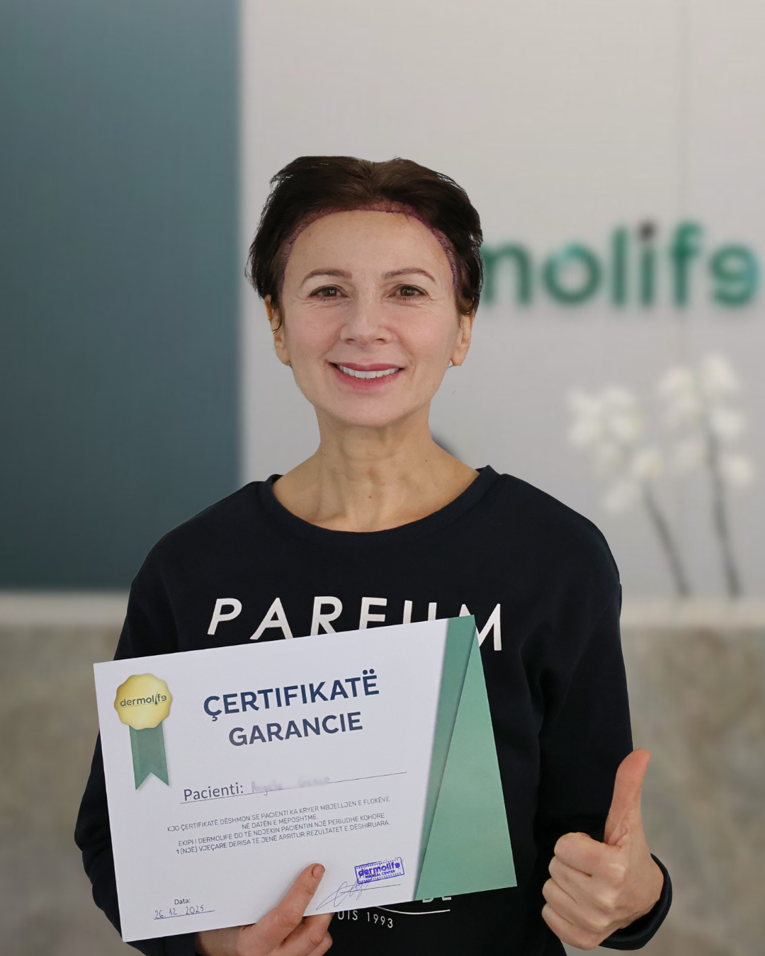 infographic showing the 4 steps of a hair transplant procedure for women